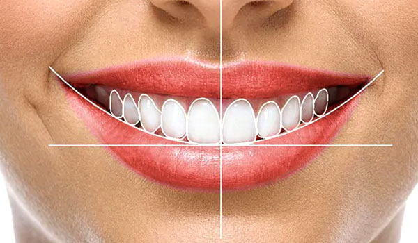 ajuste do contorno da gengiva