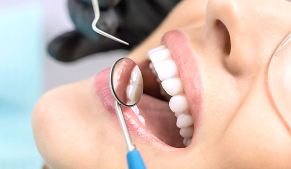 aplicação de flúor nos dentes