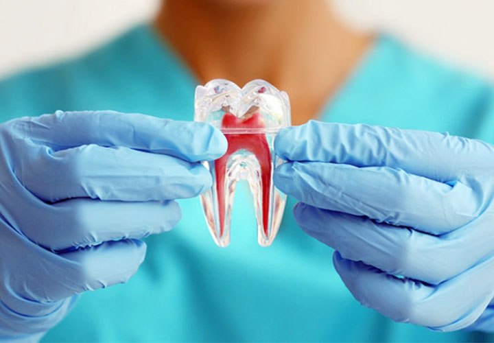 tratamento de canal e endodontia