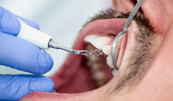 manutenção da saúde da gengiva