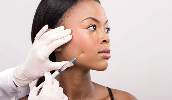 preenchimento facial com ácido hualurônico