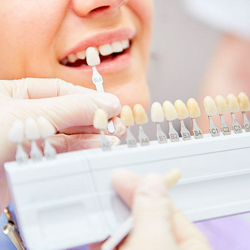 odontologia estética