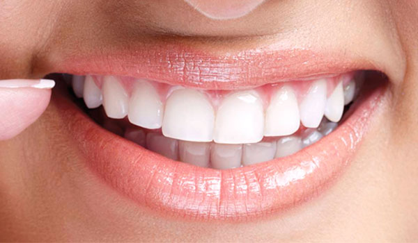 procedimentos para a harmonização do sorriso