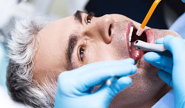 tratamento de canal para dor de dente